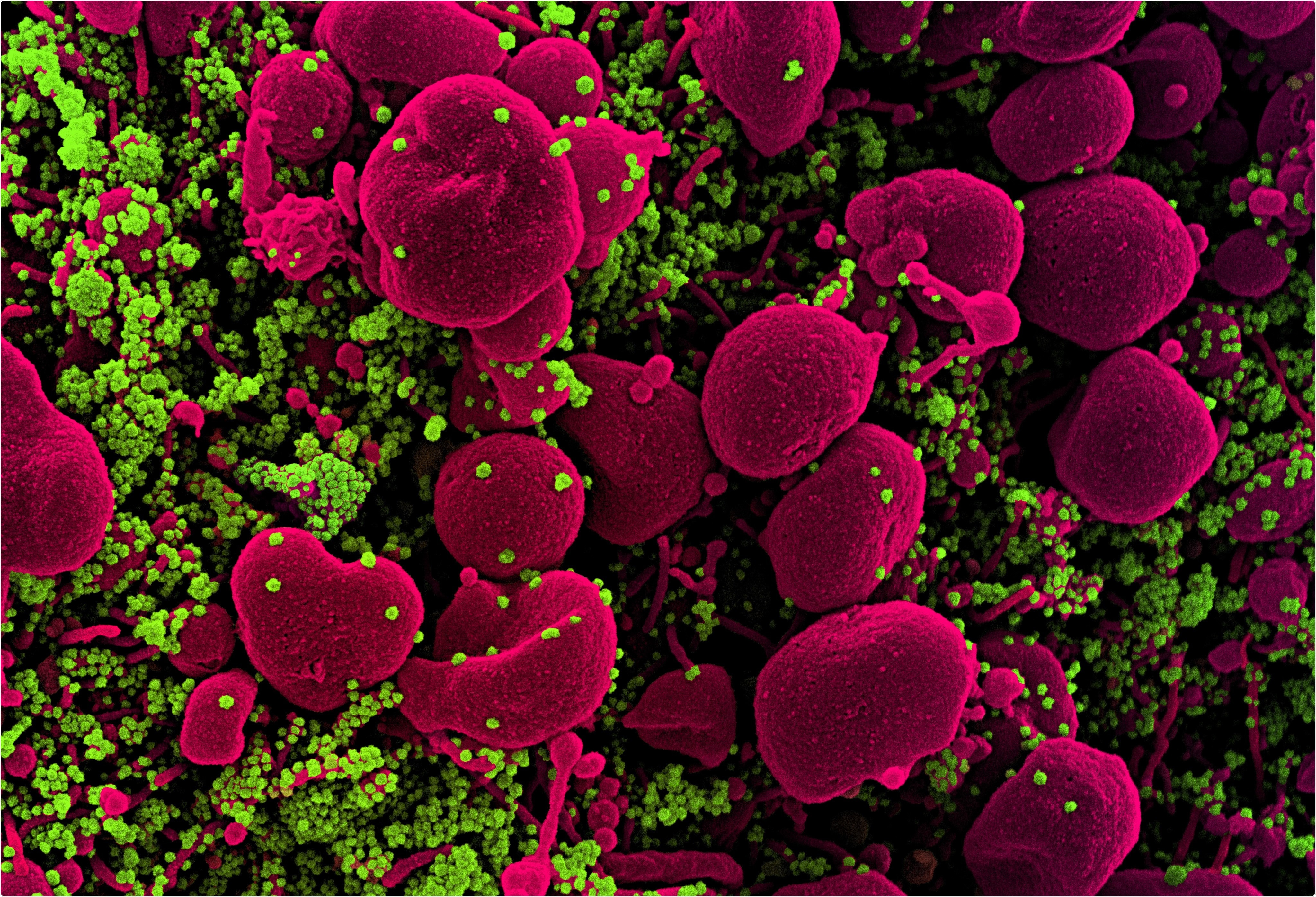 ACE2 и TMPRSS2 - не единственные вирусные рецепторы, опосредующие проникновение SARS-CoV-2 ACE2 и TMPRSS2 - не единственные вирусные рецепторы, опосредующие проникновение SARS-CoV-2