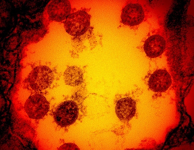 Антибиотик Х-206 эффективен против SARS-CoV-2 in vitro