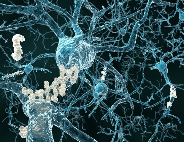 Данные секвенирования РНК выявляют три основных молекулярных подтипа болезни Альцгеймера