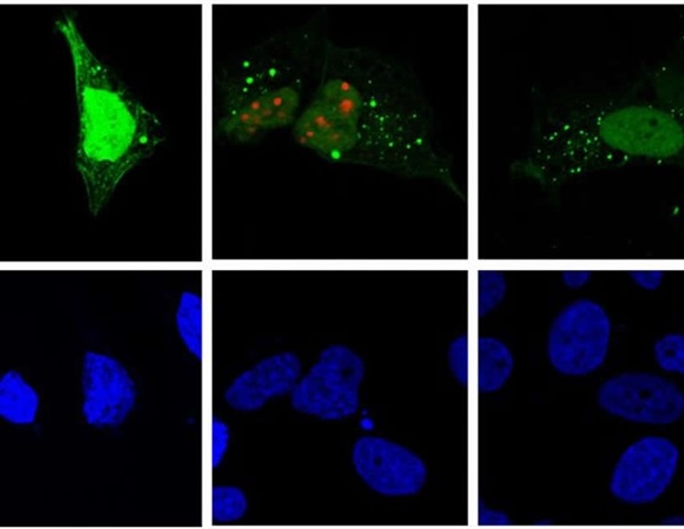 Исследования показывают, как вирус гепатита D копирует себя