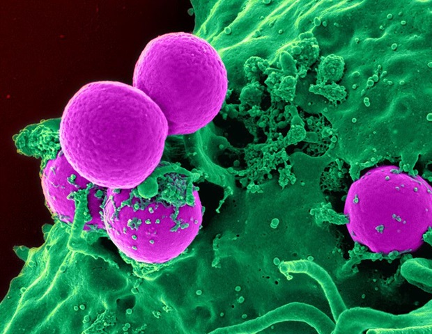 Исследователи разрабатывают новую терапию для борьбы с устойчивыми к антибиотикам инфекциями супербуг