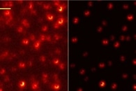 Комбинация сине-зеленых водорослей и наночастиц перспективна для лечения инсультов Комбинация сине-зеленых водорослей и наночастиц перспективна для лечения инсультов