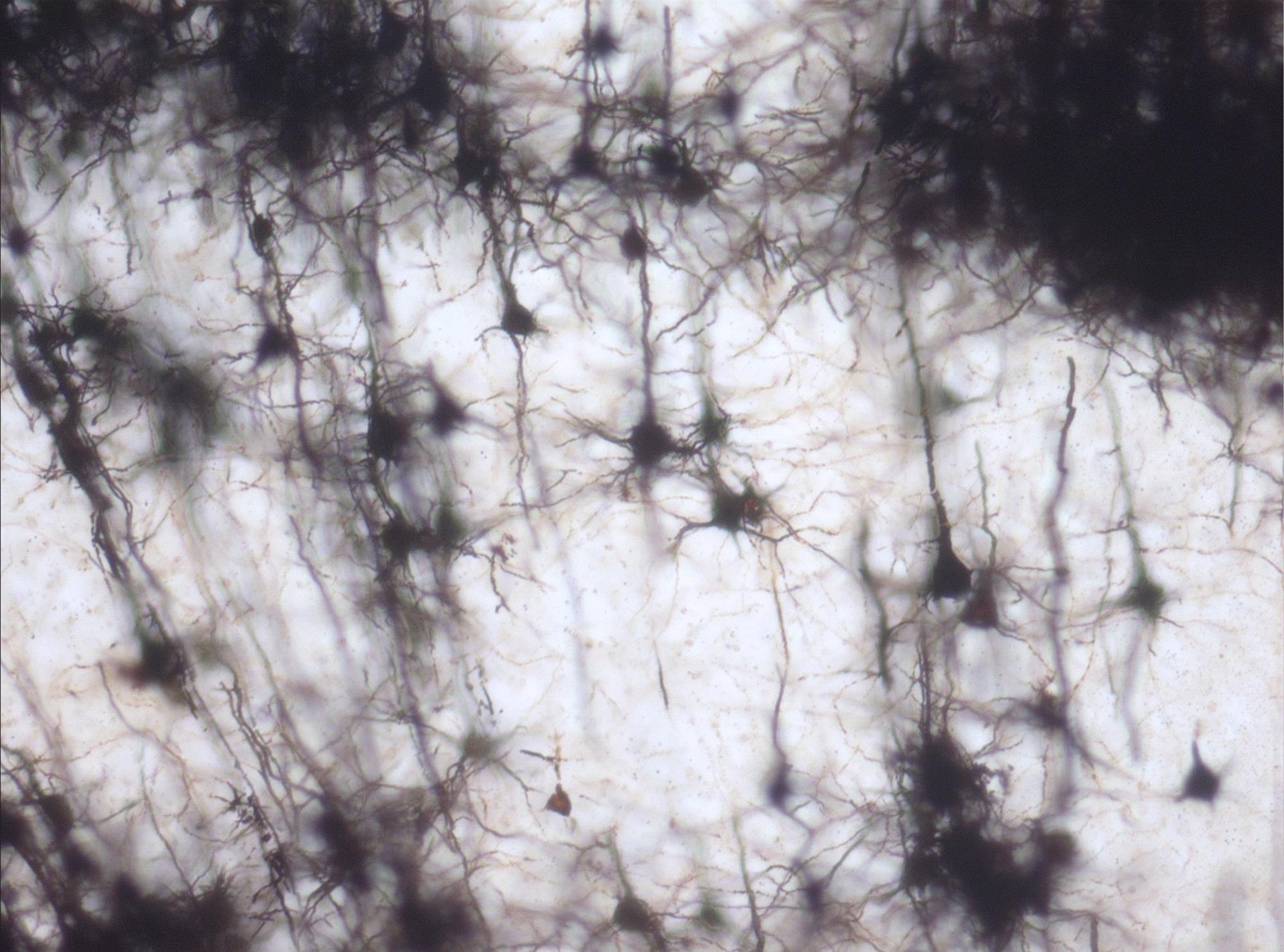 Наночастицы, нацеленные на удар, доставляют нейропротектор в мозг мыши Наночастицы, нацеленные на удар, доставляют нейропротектор в мозг мыши