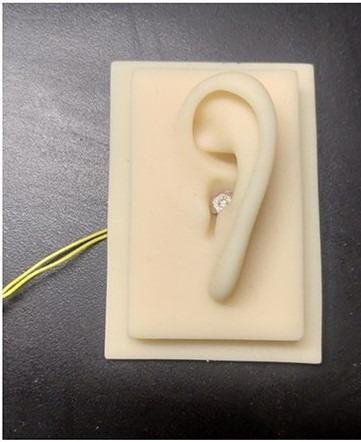 Новое устройство, разработанное для лечения потери слуха