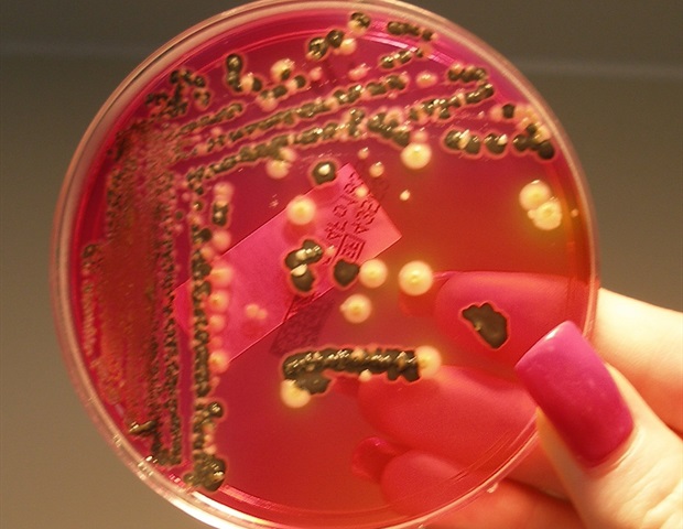 Новый защитный механизм делает смертельный штамм Salmonella устойчивым к вирусной инфекции