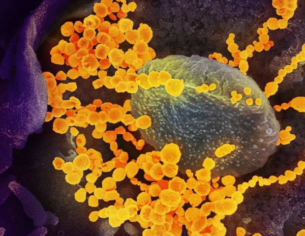 Общий антиоксидантный фермент каталаза для лечения COVID-19