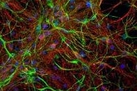 Подход перекрестной полимеризации для засеянной сборки микронных наноструктур ДНК по принципу «все или ничего» Подход перекрестной полимеризации для засеянной сборки микронных наноструктур ДНК по принципу «все или ничего»