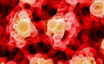 Раковые клетки расширяют наноразмерные щупальца, чтобы обезоружить злоумышленников