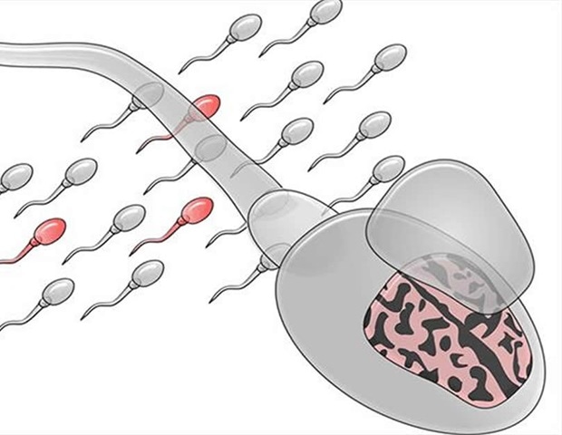 Риск аутизма у детей может быть предсказан мутациями в отцовской сперме