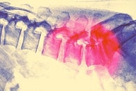 Ученые, занимающиеся рисом, создают гибридные частицы путем связывания наночастиц золота с мягкими полимерами